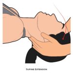 Cervical PROM_Supine Extension_spinal ROM