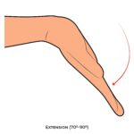 Wrist AROM_Extension_Upper Limb ROM