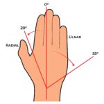 Wrist AROM_Radial-Ulnar_Upper Limb ROM