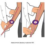 Wrist Goniometry_Abduction (radial flexion)_Upper Limb ROM