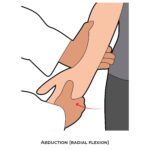Wrist PROM_Abduction (radial flexion)_Upper Limb ROM